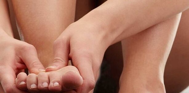 diet for arthritis