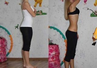 6 petals diet before and after photos